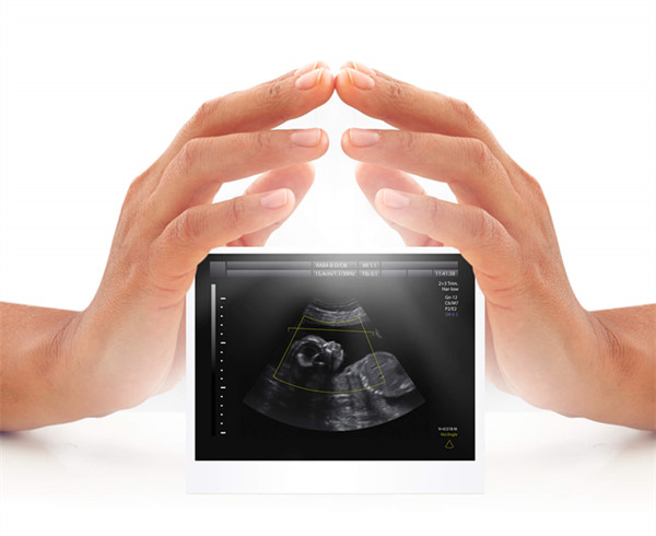 馨怡爱心捐卵公司招聘捐卵女孩加微【ivf0096】图集60